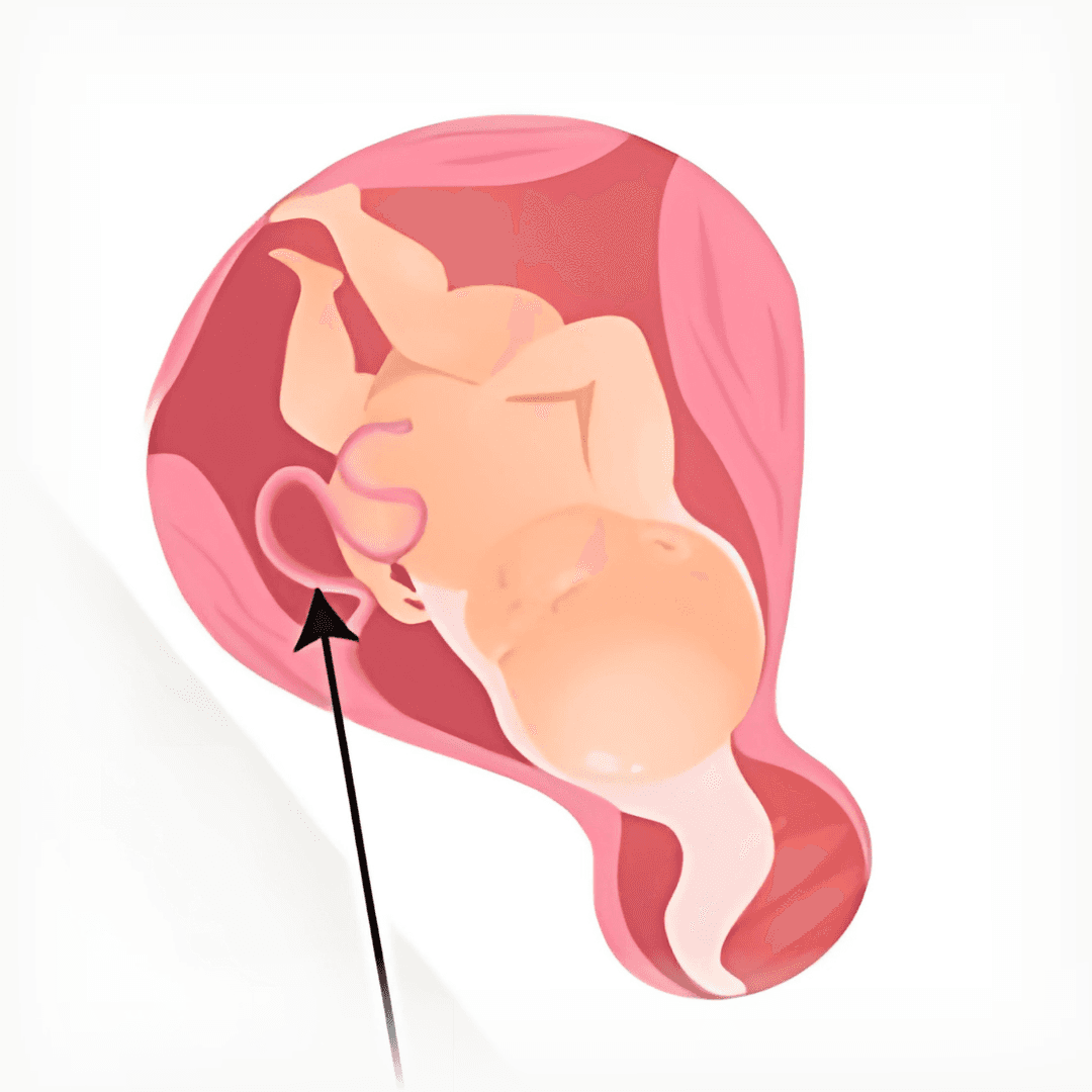 Newborn Baby in Womb Illustration
