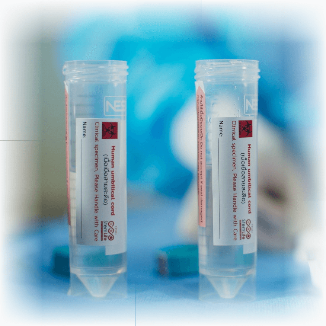 Cryopreserved Umbilical Cord Vials